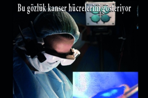 Kanser Hücrelerini Gösteren Gözlük Yapıldı.