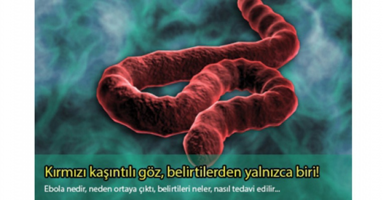 Kırmızı ve kaşıntılı göz, Ebola’nın belirtilerinden!