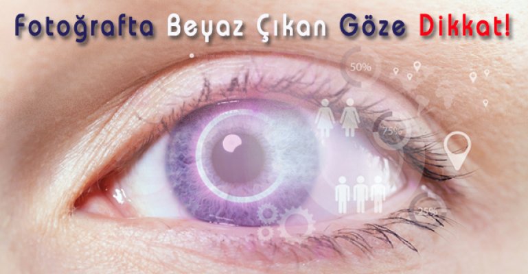 Fotoğrafta Beyaz Çıkan Göze Dikkat!