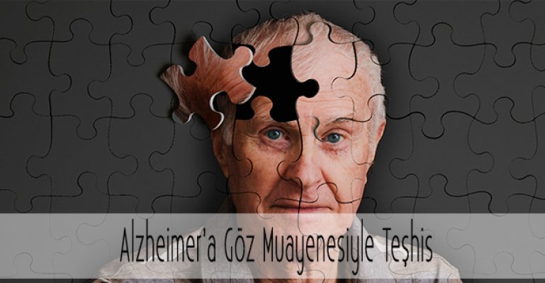 Alzheimer Göz Muayenesiyle Teşhis Edilebiliyor!