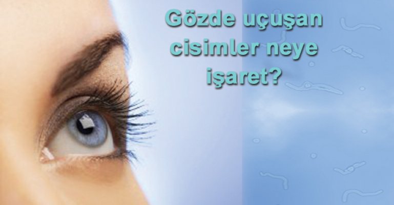 Gözünüzde ilginç cisimler uçuşuyor mu?