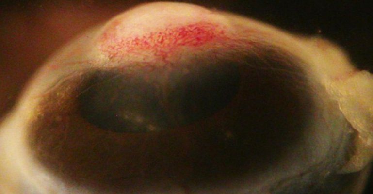 Kronik İnflamasyon ile Göz Hücrelerinin Deriye Dönüşümü