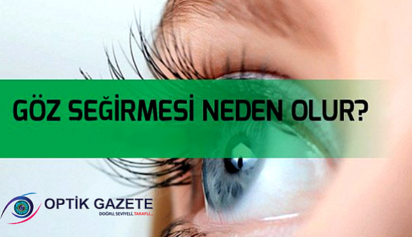 Goz Segirmesi Deyip Gecmeyiniz Optik Gazete