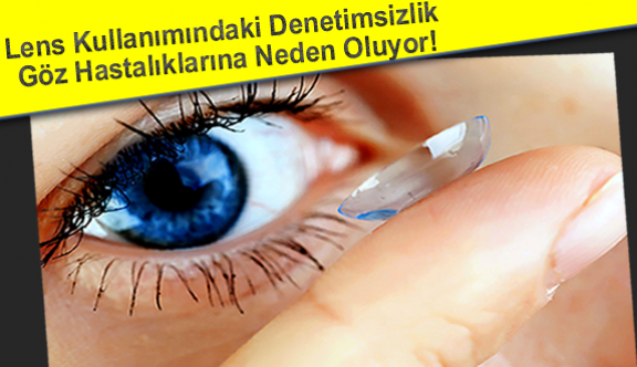 Lens Kullanımındaki Denetimsizlik Göz Hastalıklarına Neden Oluyor!
