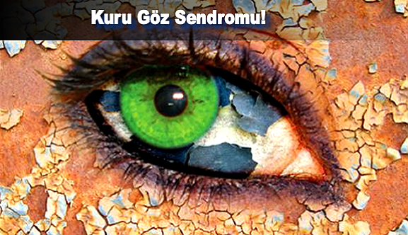 Kuru Göz Sendromu!