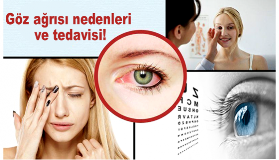 Göz ağrısı nedenleri ve tedavisi!