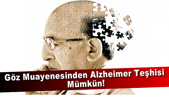 Göz Muayenesinden Alzheimer Teşhisi Mümkün!