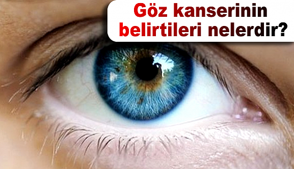 Göz kanserinin belirtileri nelerdir?