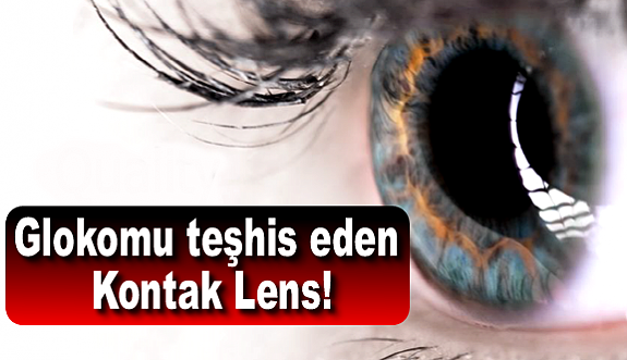 Glokomu teşhis eden kontak lens!