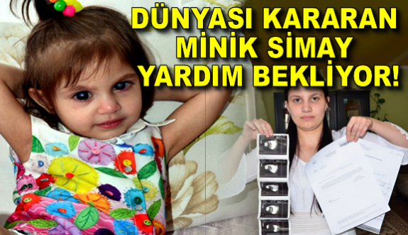 Dünyası Kararan Minik Simay Yardım Bekliyor!