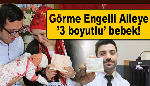 Görme Engelli Çifte ’3 boyutlu’ bebek!