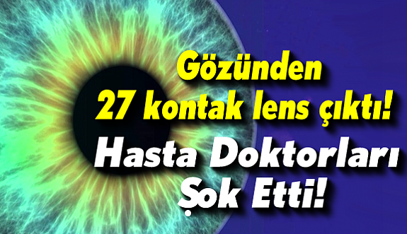 Katarakt ameliyatına gelen hastanın gözünden 27 lens çıktı!