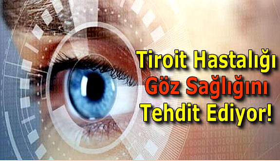 Tiroit Hastalığı Göz Sağlığını Tehdit Ediyor!