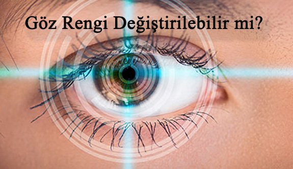 Göz Rengi Değiştirme Operasyonları Hakkında Bilinmesi Gerekenler