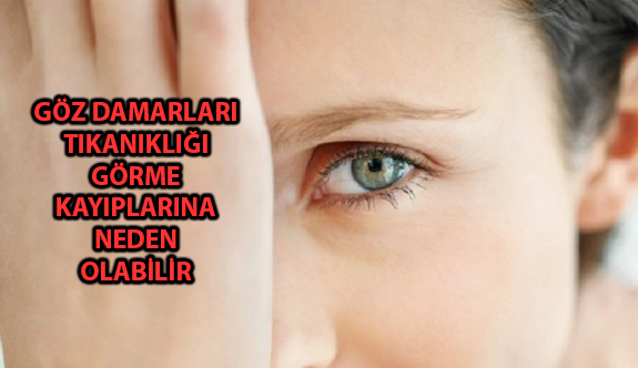 Göz Damarları Tıkanıklığı Görme Kayıplarına Neden Olabilir