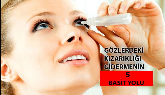 Gözlerdeki Kızarıklığı Gidermenin 5 Basit Yolu