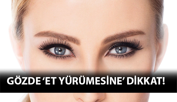 Gozde Et Yurumesine Dikkat Optik Gazete