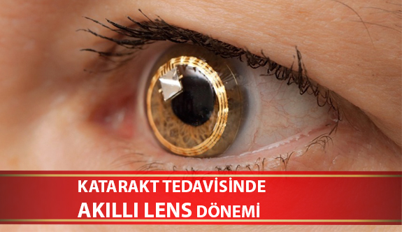 Katarakt Tedavisinde Akıllı Lens Dönemi