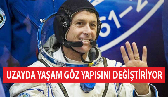 Uzayda Yaşam Göz Yapısını Değiştiriyor