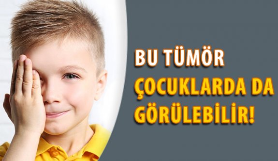 "Göz Tümörleri Çocukluk Çağında da Görülebilir. "