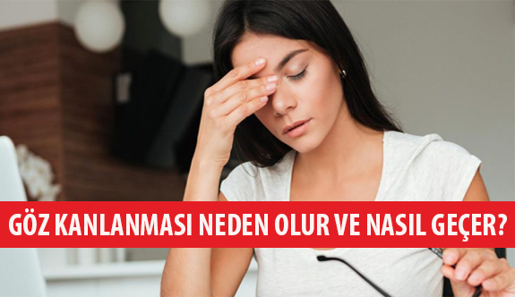 Göz Kanlanması Neden Olur ve Nasıl Geçer?