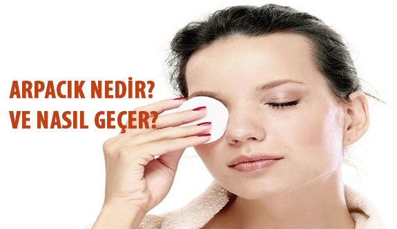 Arpacık Nedir? Arpacık Neden Olur ve Nasıl Geçer?