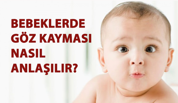 Bebeklerde Göz Kayması Nasıl Anlaşılır?