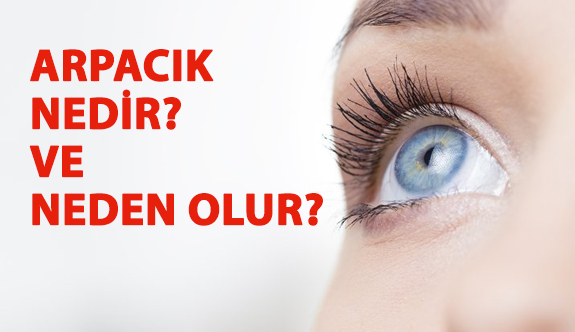 Arpacık Nedir? ve Neden Olur?