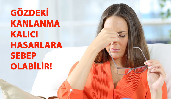 Gözdeki Kanlanma Kalıcı Hasarlara Sebep Olabilir!