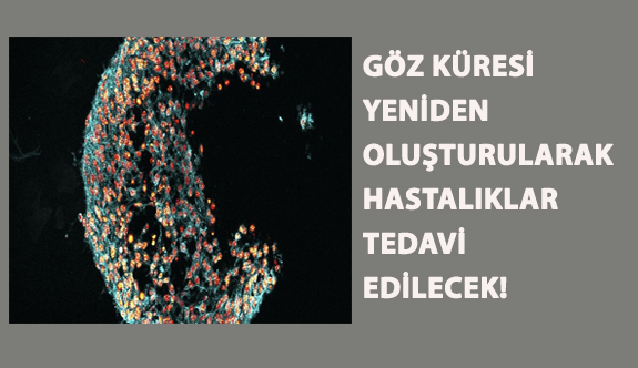 Göz Küresi Yeniden Oluşturularak Hastalıklar Tedavi Edilecek!