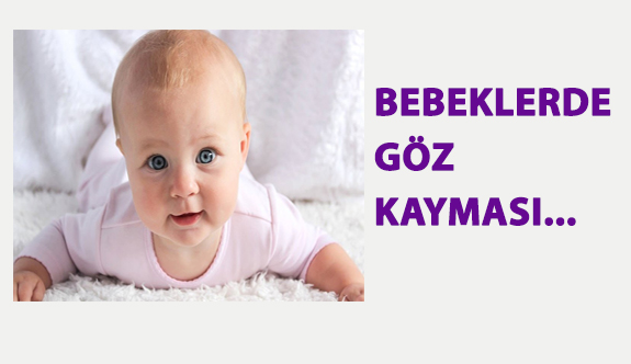 Bebeklerde Göz Kayması…