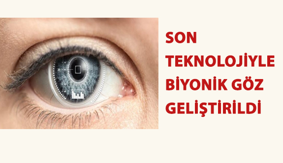 Son Teknolojiyle Biyonik Göz Geliştirildi