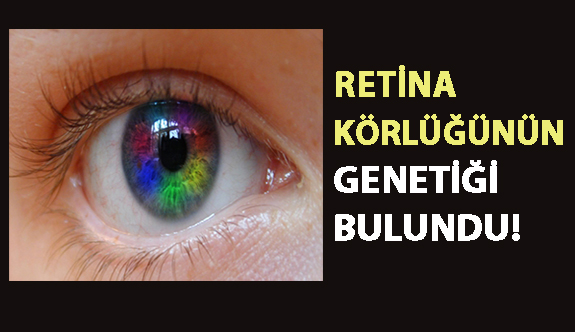 Retina Körlüğünün Genetiği Bulundu!