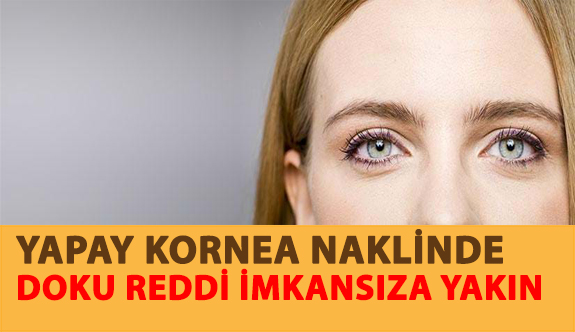 Yapay Kornea Naklinde Doku Reddi İmkansıza Yakın...