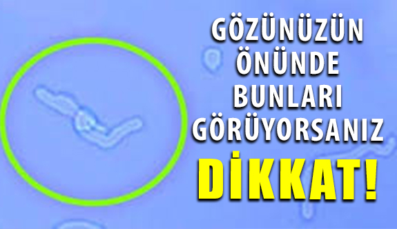 Gözde Sinek Uçuşmaları Varsa Göz Hekimine Başvurun