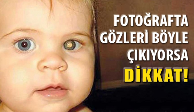 Fotoğraflarda Çocukların Göz Bebeğine Dikkat!