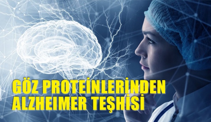 Göz Proteinleri Seviyesi Alzheimer Potansiyeli Tespitini Sağlıyor