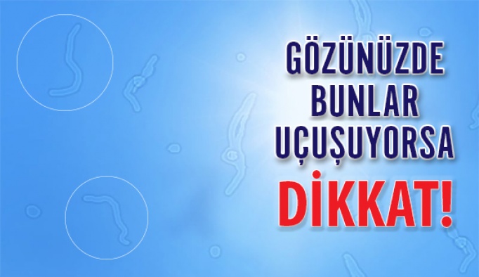 Gözdeki Sinek Uçuşmalarına Ve Lekelere Dikkat!