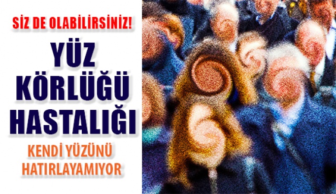 Yüz Körlüğü Hastalığı: 'Sevdiklerimin Yüzünü Hatırlayamıyorum'