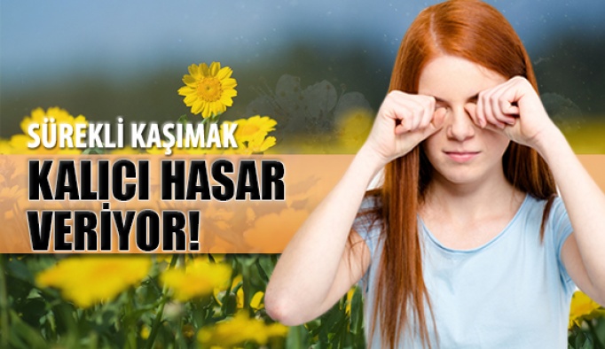 Sürekli Göz Kaşıma Kalıcı Hasar Veriyor