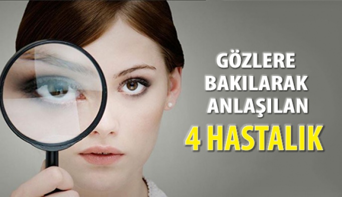 4 Hastalık Gözlere Bakılarak Anlaşılıyor