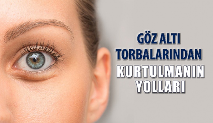 Göz Altı Torbalarından Nasıl Kurtulursunuz?