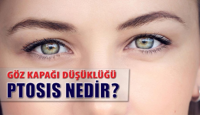 Göz Kapağı Düşüklüğü (Ptosis) Nedir?