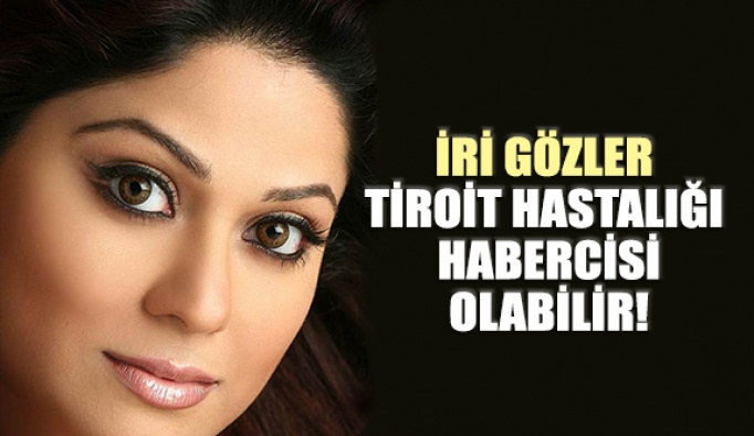 İri Gözler Tiroit Hastalığı Habercisi Olabiliyor!