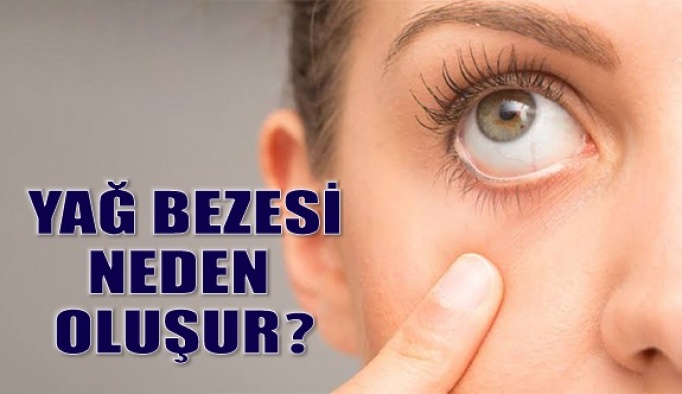 Göz Çevresindeki Yağ Bezeleri Neden Olur?