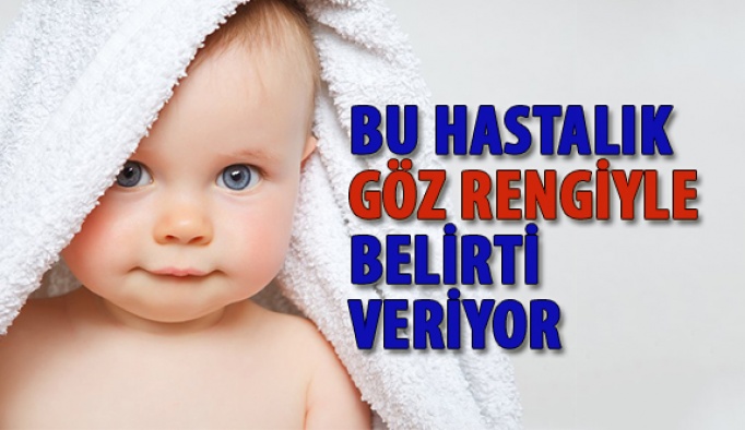 Bu Hastalık Göz Rengiyle Belirti veriyor