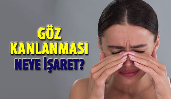 Göz Kanlanması Neye İşaret?