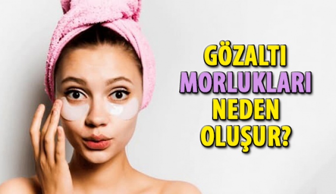 Gözaltı Morlukları Neden Olur?