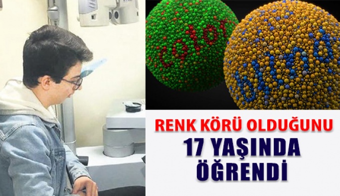 Renk Körü Olduğunu 17 Yaşında Öğrendi