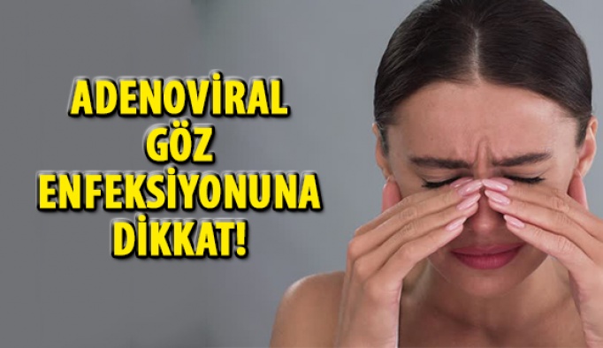 Adenoviral Göz Enfeksiyonuna Dikkat!